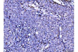 IHC analysis of RAE1 using anti-RAE1 antibody (ABIN7602428).