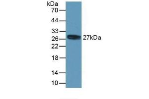 Detection of Recombinant MYL4, Human using Polyclonal Antibody to Myosin Light Chain 4, Alkali, Atrial, Embryonic (MYL4) (MYL4 抗体  (AA 6-191))