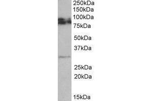 AP23233PU-N GPM6A antibody staining of Rat Brain lysate at 0. (GPM6A 抗体  (Internal Region))