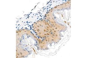 Immunohistochemistry of paraffin embedded mouse stomach using COPS2 (ABIN7073324) at dilution of 1:1400 (400x lens) (CSN2 抗体)
