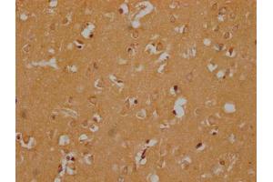 Immunohistochemistry (IHC) image for anti-Olfactory Receptor, Family 6, Subfamily B, Member 3 (OR6B3) (AA 259-272) antibody (ABIN7140024)