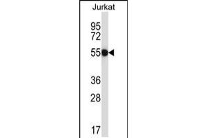 Western blot analysis in Jurkat cell line lysates (35ug/lane). (CNOT2 抗体  (AA 272-301))