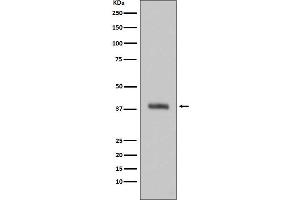 Western blot analysis of HTRA2 expression in Jurkat cell lysate.