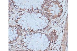 Immunohistochemistry (Paraffin-embedded Sections) (IHC (p)) image for anti-SNW Domain Containing 1 (SNW1) antibody (ABIN7257970)