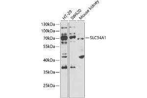 Western blot analysis of extracts of various cell lines, using SLC34 antibody  at 1:1000 dilution. (Solute Carrier Family 34 (Type II Sodium/phosphate Contransporter), Member 1 (SLC34A1) 抗体)