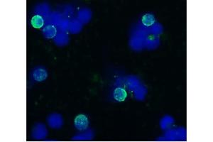 Immunocytochemistry staining of acetone/methanol fixed bovine peripheral blood (lymphocyte-enriched suspension) using anti-bovine CD45R (IVA103), secondary antibody conjugated to FITC (green), DNA stained with DAPI (blue). (CD45 抗体)