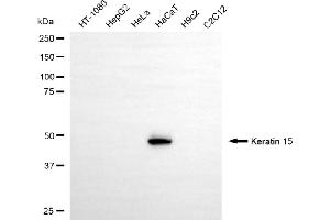 Western blotting analysis using keratin 15 antibody (ABIN7799169).
