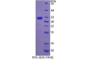 SDS-PAGE analysis of Rat NCR1 Protein. (NCR1 蛋白)