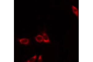 ABIN6274392 staining Hela by IF/ICC. (FASTKD1 抗体  (Internal Region))