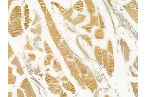 ABIN6258751 and ABIN6274763 at 1/100 staining human tongue carcinoma by IHC-P.