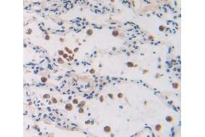 Used in DAB staining on fromalin fixed paraffin- embedded lung tissue (GTF2A2 抗体  (AA 1-109))