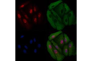 ABIN6258847 and ABIN6275709 staining  cells by IF/ICC. (RAD23B 抗体  (N-Term))