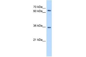 WB Suggested Anti-PPP2R3B Antibody Titration:  0. (PPP2R3B 抗体  (C-Term))