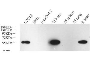 Western Blot analysis of various samples using Desmin Monoclonal Antibody at dilution of 1:1000. (Desmin 抗体)