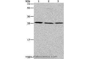 Western blot analysis of Human fetal liver tissue, 293T and 231 cell, using TP53INP1 Polyclonal Antibody at dilution of 1:200 (TP53INP1 抗体)