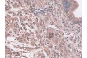 DAB staining on IHC-P; Samples: Mouse Uterus Tissue (NAT1 抗体  (AA 9-254))