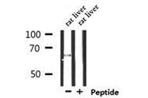 Western Blotting (WB) image for anti-Solute Carrier Family 6 (Proline IMINO Transporter), Member 20 (SLC6A20) (Internal Region) antibody (ABIN6265146)
