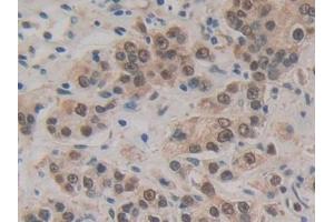 Immunohistochemistry (IHC) image for anti-Heat Shock 70kDa Protein 1A (HSPA1A) (AA 285-641) antibody (ABIN7443083)