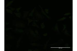 Immunofluorescence of monoclonal antibody to USP9X on HeLa cell. (USP9X 抗体  (AA 1-90))
