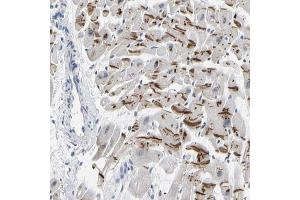 Immunohistochemical staining (Formalin-fixed paraffin-embedded sections) of human heart muscle with PKP2 polyclonal antibody  shows strong cytoplasmic positivity in myocytes. (Plakophilin 2 抗体  (AA 72-194))