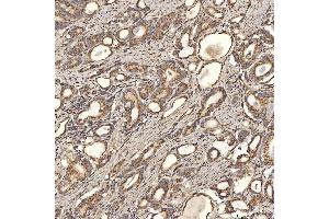 IHC analysis of SLC25A24 using anti-SLC25A24 antibody (ABIN7599228).