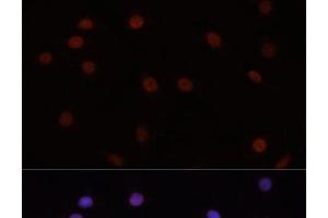 Immunofluorescence analysis of C6 cells using DNMT3B Polyclonal Antibody at dilution of 1:100. (DNMT3B 抗体)
