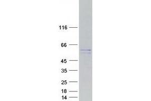 Western Blotting (WB) image for Mirror-Image Polydactyly 1 (MIPOL1) protein (Myc-DYKDDDDK Tag) (ABIN2726064)