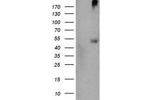 Western Blotting (WB) image for anti-Sedoheptulokinase (SHPK) antibody (ABIN1500922) (SHPK 抗体)