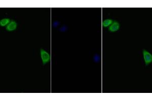 Detection of IL11Ra in Human Hela cell using Polyclonal Antibody to Interleukin 11 Receptor Alpha (IL11Ra) (IL11RA 抗体  (AA 194-329))