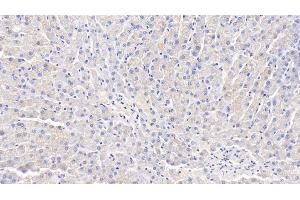 Detection of ADPN in Canine Liver Tissue using Polyclonal Antibody to Adiponectin (ADPN) (ADIPOQ 抗体  (AA 18-244))