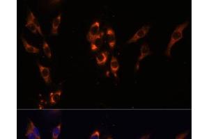 Immunofluorescence analysis of HeLa cells using PDE3A Polyclonal Antibody at dilution of 1:100 (40x lens). (PDE3A 抗体)