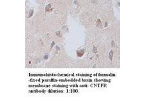 Image no. 1 for anti-Ciliary Neurotrophic Factor Receptor (CNTFR) antibody (ABIN791093) (CNTF Receptor alpha 抗体)