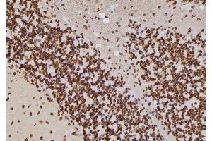 ABIN6257255 and ABIN6274428 at 1/100 staining Rat brain tissue by IHC-P. (HIPK4 抗体  (C-Term))