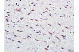 Immunohistochemistry (Paraffin-embedded Sections) (IHC (p)) image for anti-C-Type Lectin Domain Family 14, Member A (CLEC14A) (AA 260-310) antibody (ABIN1385496)