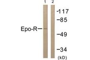 Western blot analysis of extracts from COS7 cells, treated with EPO 20U/ml 15', using Epo-R (Ab-368) Antibody. (EPOR 抗体  (AA 341-390))