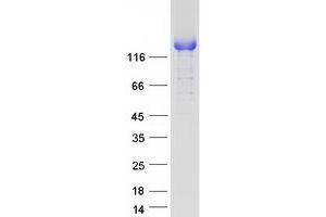 Validation with Western Blot