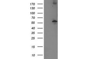 Western Blotting (WB) image for anti-Protein Phosphatase, Mg2+/Mn2+ Dependent, 1B (PPM1B) antibody (ABIN1500375) (PPM1B 抗体)