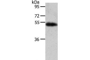 Western Blot analysis of Human liver cancer tissue using AGT Polyclonal Antibody at dilution of 1:700 (AGT 抗体)