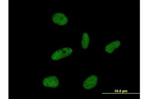 Immunofluorescence of purified MaxPab antibody to ORC6L on HeLa cell. (ORC6 抗体  (AA 1-252))