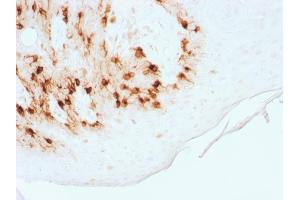 Formalin-fixed, paraffin-embedded human Skin stained with MART-1 Rabbit Recombinant Monoclonal Antibody (MLANA/1761R) (HRP-DAB). (Recombinant MLANA 抗体)