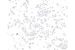 Immunocytochemistry (ICC) image for anti-Zinc Finger CCCH-Type Containing 4 (ZC3H4) (AA 1050-1100) antibody (ABIN7795759)