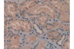 Immunohistochemistry (IHC) image for anti-Tafazzin (TAZ) (AA 154-292) antibody (ABIN1860685)