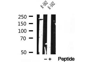 Western blot analysis of extracts of K-562 cells, using RB1CC1 antibody. (FIP200 抗体)