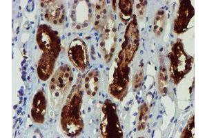 Immunohistochemistry (IHC) image for anti-NQO2 (NQO2) antibody (ABIN1499816) (NQO2 抗体)