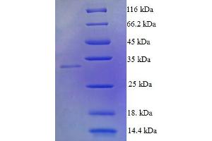 SDS-PAGE (SDS) image for Tumor Necrosis Factor (Ligand) Superfamily, Member 10 (TNFSF10) (AA 39-281), (Extracellular) protein (His tag) (ABIN5710526)