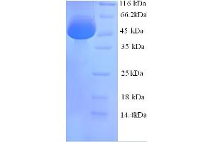 SDS-PAGE (SDS) image for Calreticulin (CALR) (AA 18-416) protein (His tag) (ABIN5713308) (Calreticulin Protein (CALR) (AA 18-416) (His tag))