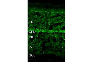 Immunohistochemistry (IHC) image for anti-Erythrocyte Membrane Protein Band 4.1 (Elliptocytosis 1, RH-Linked) (EPB41) (AA 1-180) antibody (ABIN1742539)