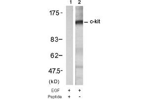 Image no. 1 for anti-Mast/stem Cell Growth Factor Receptor (KIT) (Tyr721) antibody (ABIN319333) (KIT 抗体  (Tyr721))