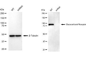 Western blotting analysis using Glucocorticoid Receptor antibody (ABIN7799658).