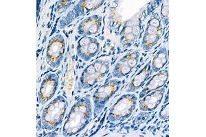 Immunohistochemistry analysis of paraffin embedded rat colon using CYPIW1 (ABIN7073674) at dilution of 1: 500 (CYP2W1 抗体)